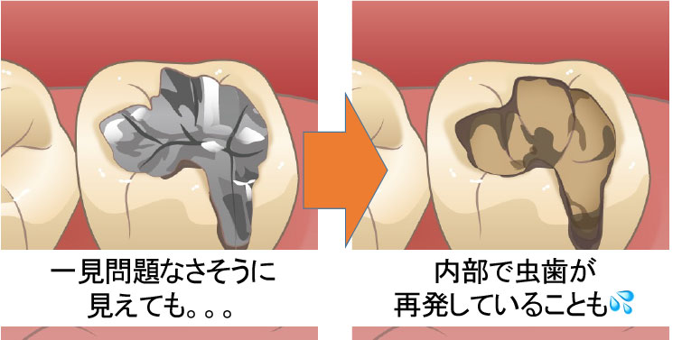 装着後、劣化のイメージ